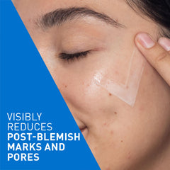 CeraVe Resurfacing Retinol Serum For Blemish-Prone Skin, Reduces Post Acne Marks & Pores, Formulated with Licorice Root Extract & Niacinamide, Non-Comedogenic, 30ml