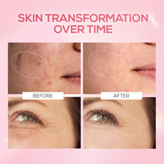 RENEE Pink Therapy PDRN Pink Peptide Face Serum For Glowing, Radiant Skin | Hydrates, Boosts Collagen, Evens Skin Tone | Hyaluronic Acid & Niacinamide Infused | 30 ml