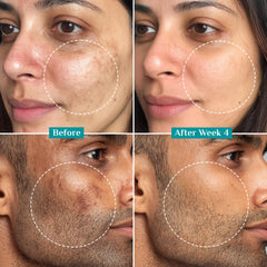 Pilgrim 15% Vitamin C Serum 20ml For Glowing Skin | Advanced Formulation With Ferulic Acid & Vitamin E |Reduces Dark Spots, Pigmentation |For All, Oily, Combination, Normal Skin |Men, Women