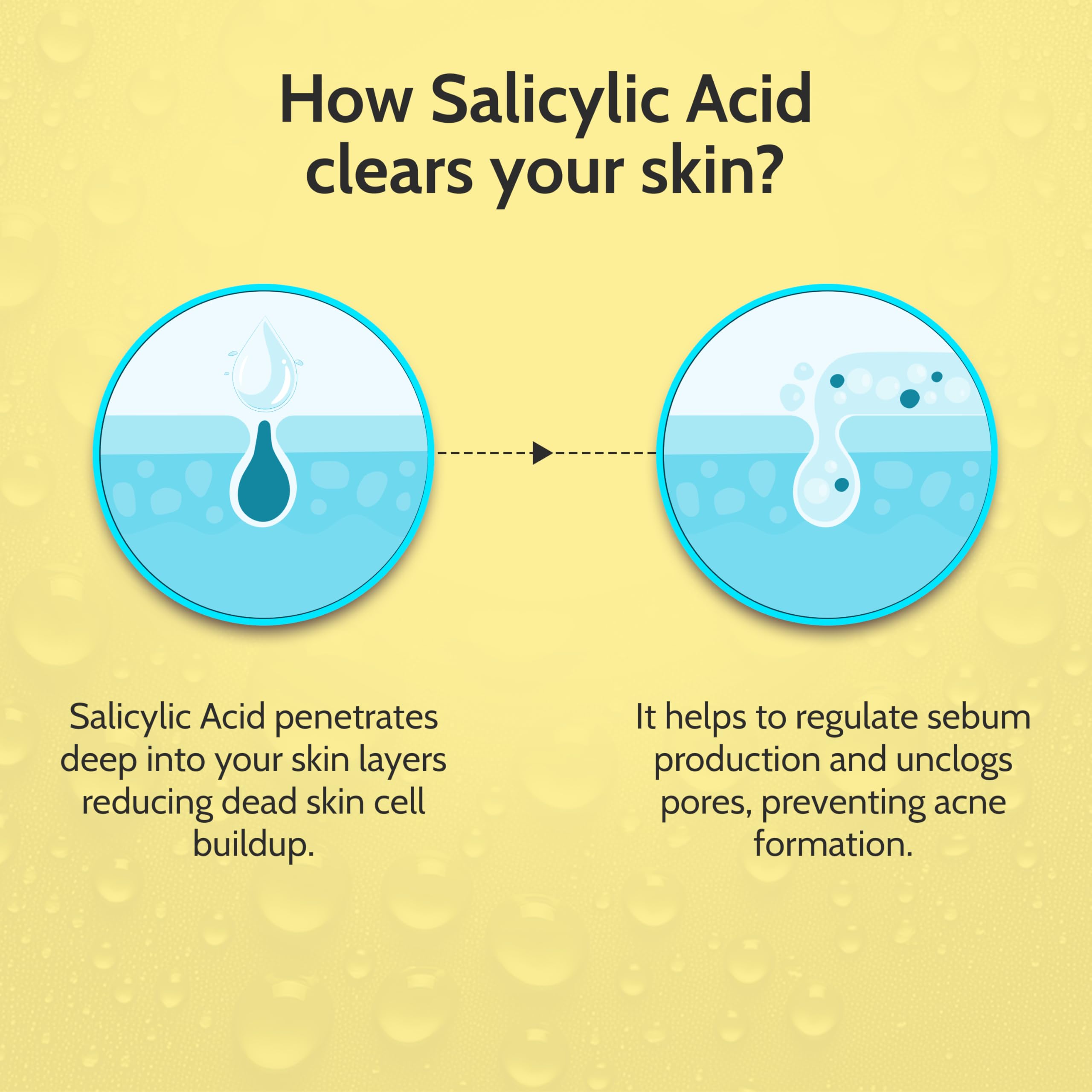 Chemist At Play 2% Salicylic Acid Face Serum | Treats Active Acne | Controls Excess Oil | Fades Acne Marks | Improves Skin Texture | 30ml
