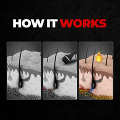 Beardo Beard Booster Combo | Beard Activator Advance Derma Roller for Men with 540 Chromium needles 0.5 mm | Beard and Hair Growth Oil - 50 ml for faster beard growth and thicker looking beard