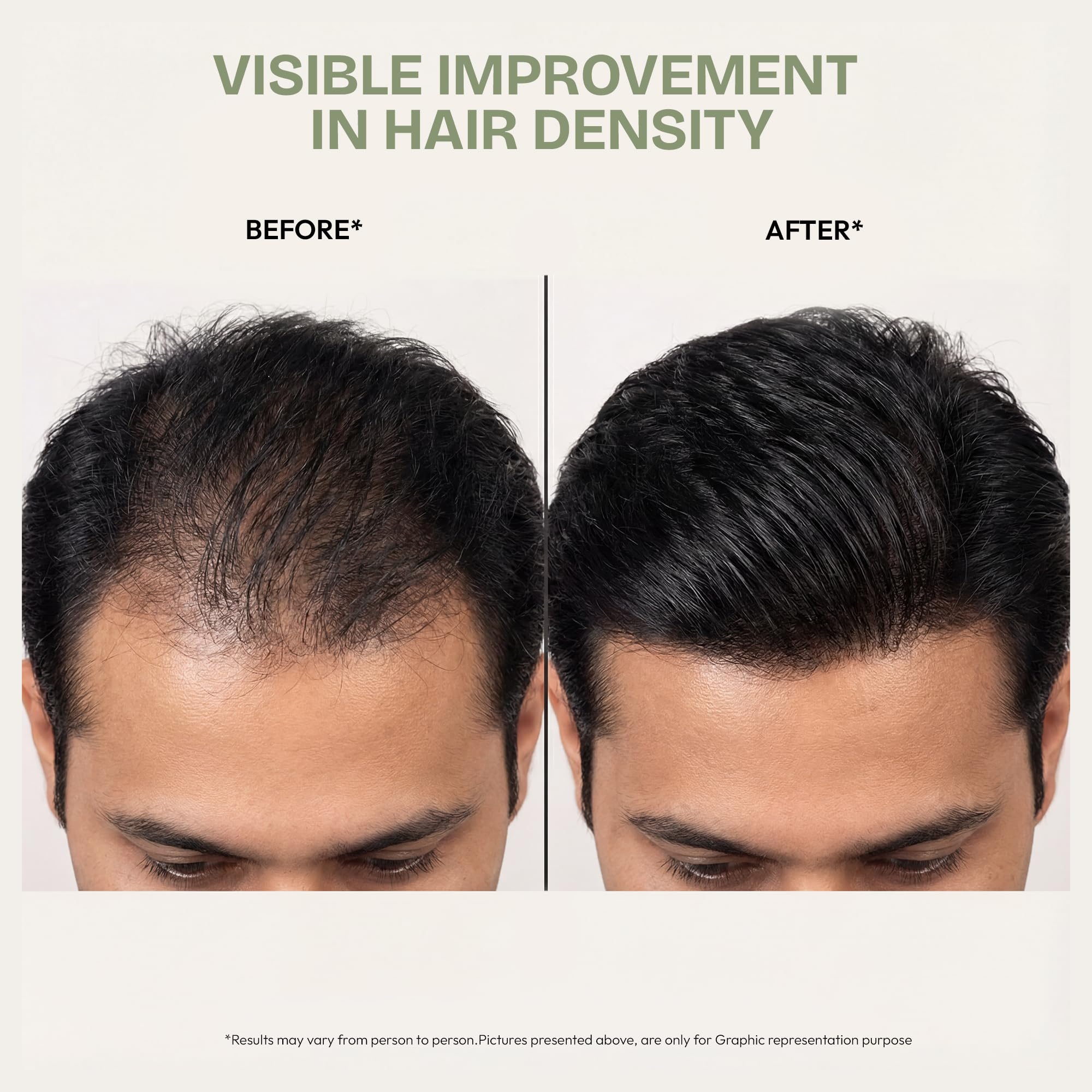 Proskire Ultimate Hair Growth Oil | Lightweight Non-Greasy Hair Growth Oil with Rosemary, Batana & Bhringraj | Reduces Hair Fall & Boosts Hair Density - 100ml