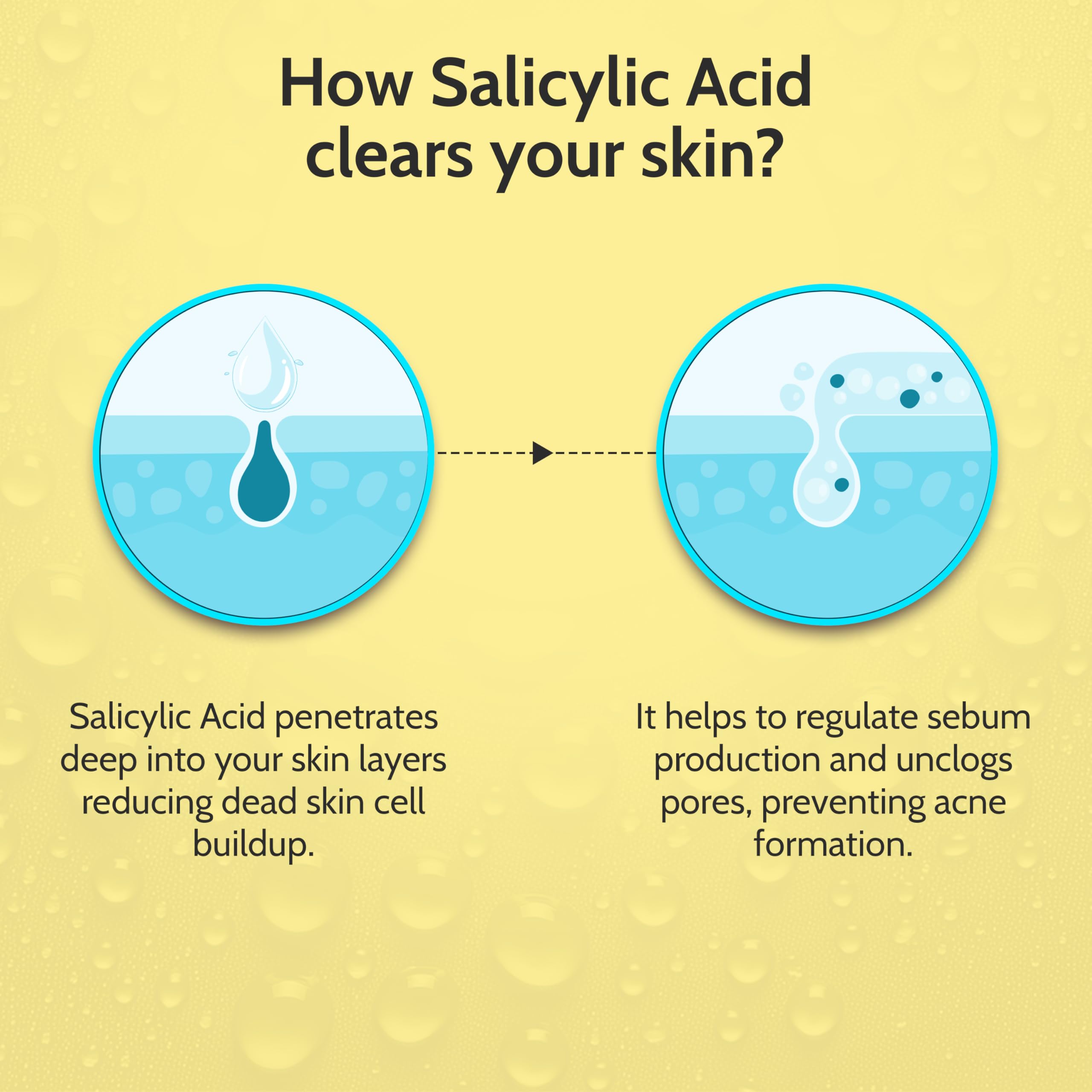 Chemist At Play 2% Salicylic Acid Face Serum | Treats Active Acne | Controls Excess Oil | Fades Acne Marks | Improves Skin Texture | 30ml