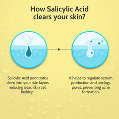 Chemist At Play 2% Salicylic Acid Face Serum | Treats Active Acne | Controls Excess Oil | Fades Acne Marks | Improves Skin Texture | 30ml